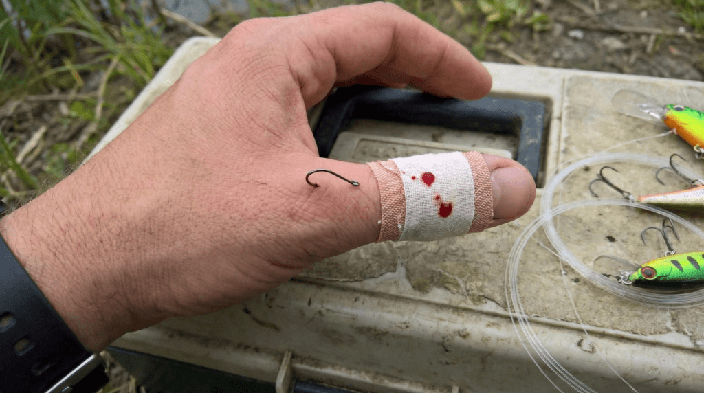 Hook punctures are common on the water, and they get dirty fast, this scene was created with AI.